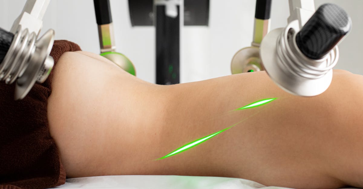 discover the benefits of laser therapy for pain relief, skin rejuvenation, and enhanced healing. explore innovative treatments that harness the power of light to promote wellness and recovery.