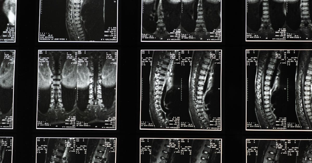 découvrez des solutions et des informations efficaces pour gérer la douleur lombaire. découvrez les causes, les options de traitement et les conseils de soulagement nécessaires pour améliorer votre qualité de vie.