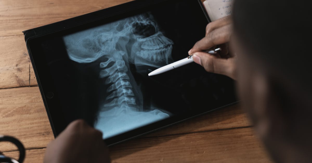 discover the causes and solutions for 'tech neck,' a common issue caused by prolonged use of digital devices. learn how to alleviate discomfort and improve posture with effective exercises and ergonomic tips to keep your neck healthy.