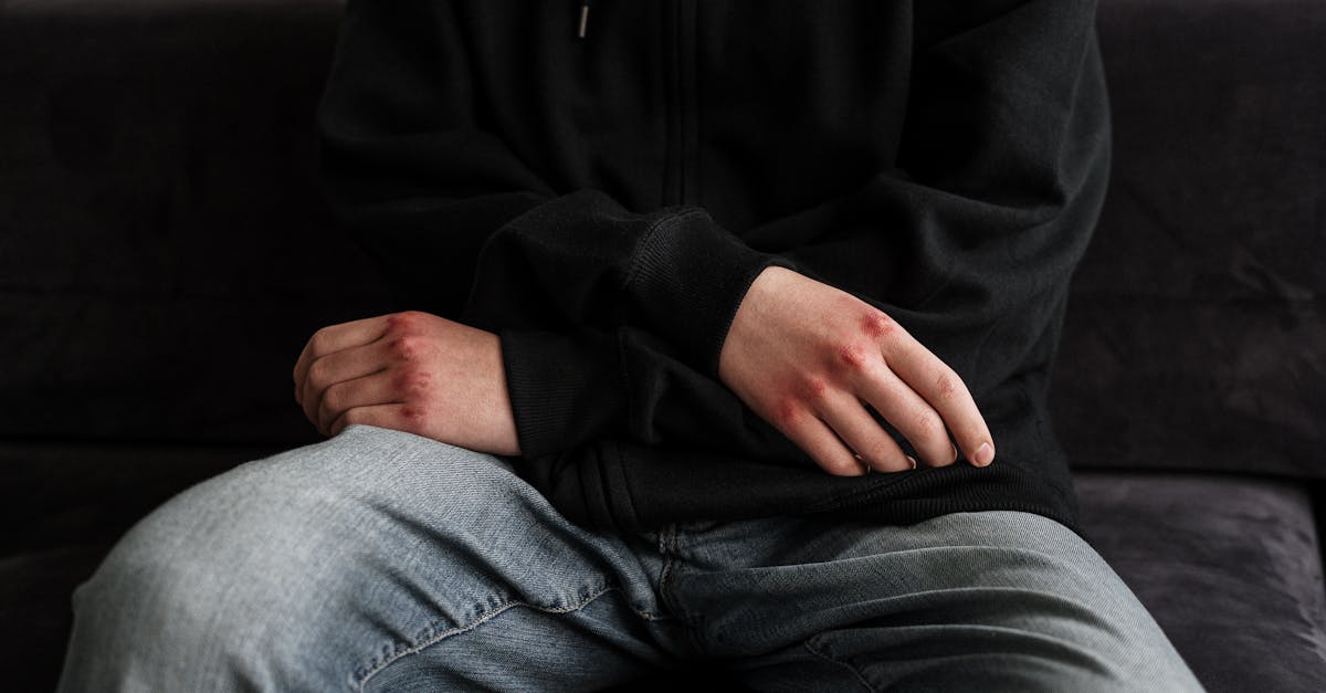 explore the complexities of brachial plexus injuries, including causes, symptoms, and treatment options. learn how to manage and rehabilitate these conditions for improved mobility and quality of life.
