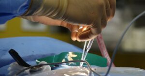 learn about herniated discs, their causes, symptoms, and treatment options. discover how this common spinal condition can affect your quality of life and the best ways to manage pain and restore mobility.