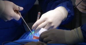 discover the causes, symptoms, and treatments of a herniated disc. learn how to manage pain and improve mobility with effective strategies and expert advice.
