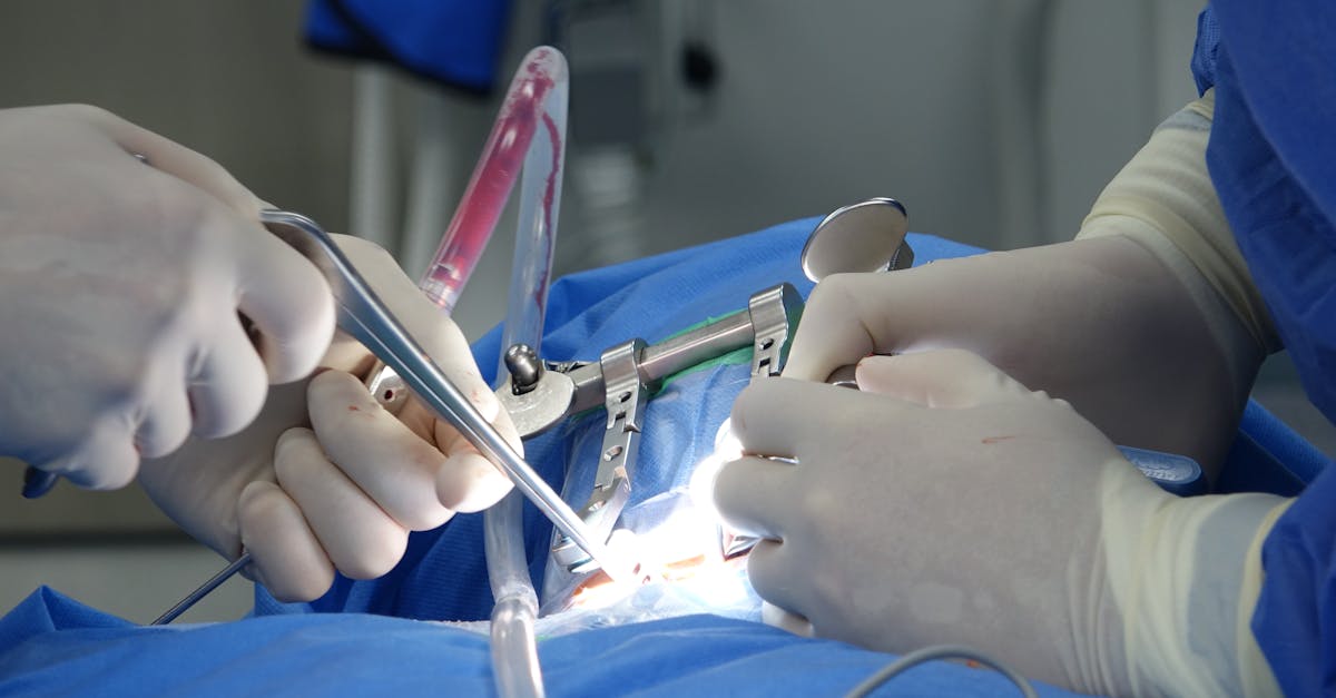 learn about spinal stenosis, a narrowing of the spinal canal that can cause pain and discomfort. explore its symptoms, causes, and treatment options to manage your condition effectively.