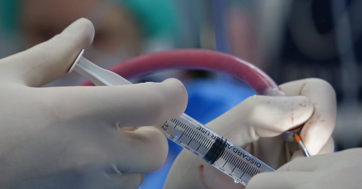 discover comprehensive information on spinal stenosis, including symptoms, causes, diagnosis, and treatment options. learn how to manage this condition effectively and improve your quality of life.