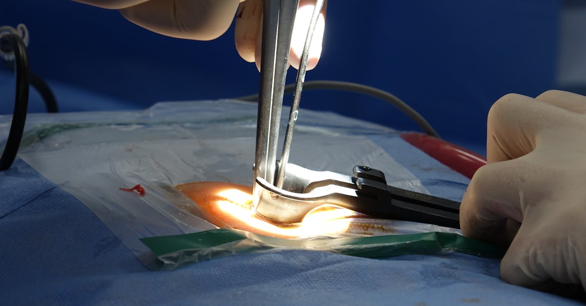 explore the causes, symptoms, and treatment options for spinal stenosis. understand how this condition affects the spine and learn about effective management strategies to alleviate pain and improve mobility.
