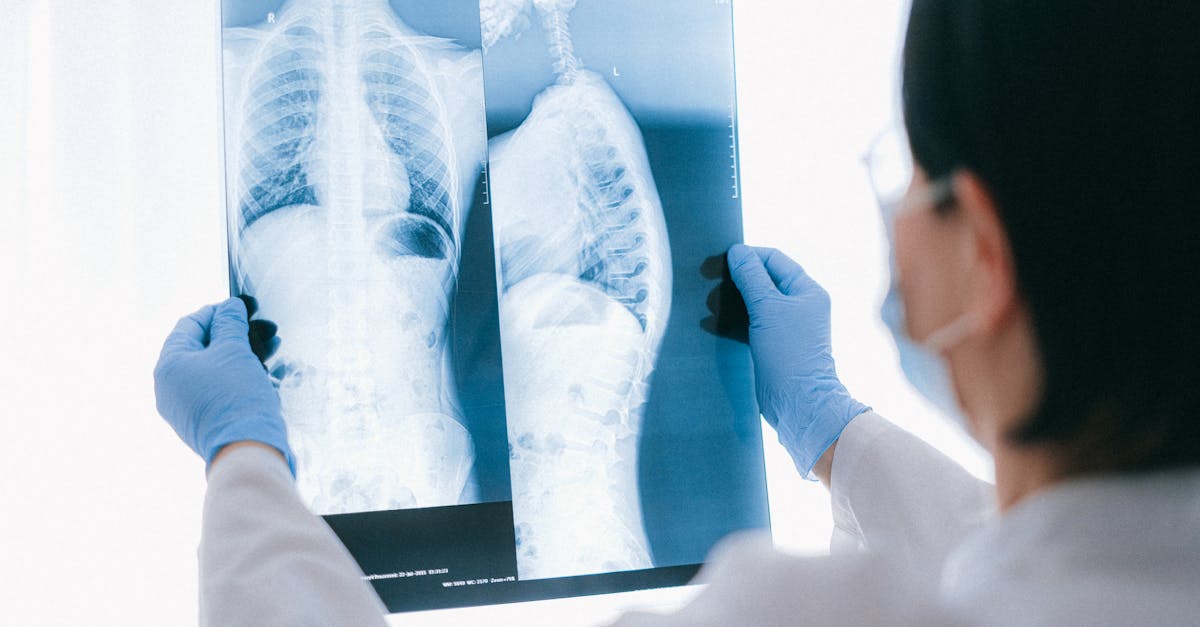 discover effective strategies to understand and alleviate thoracic spine pain. learn about the causes, symptoms, and treatments to help you regain your mobility and improve your quality of life.