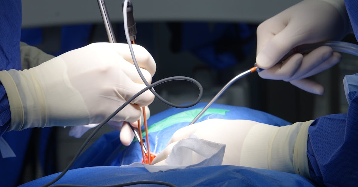 discover the causes, symptoms, and treatment options for spinal stenosis. understand how this condition affects the spine, leading to pain and discomfort, and explore effective solutions to improve your quality of life.