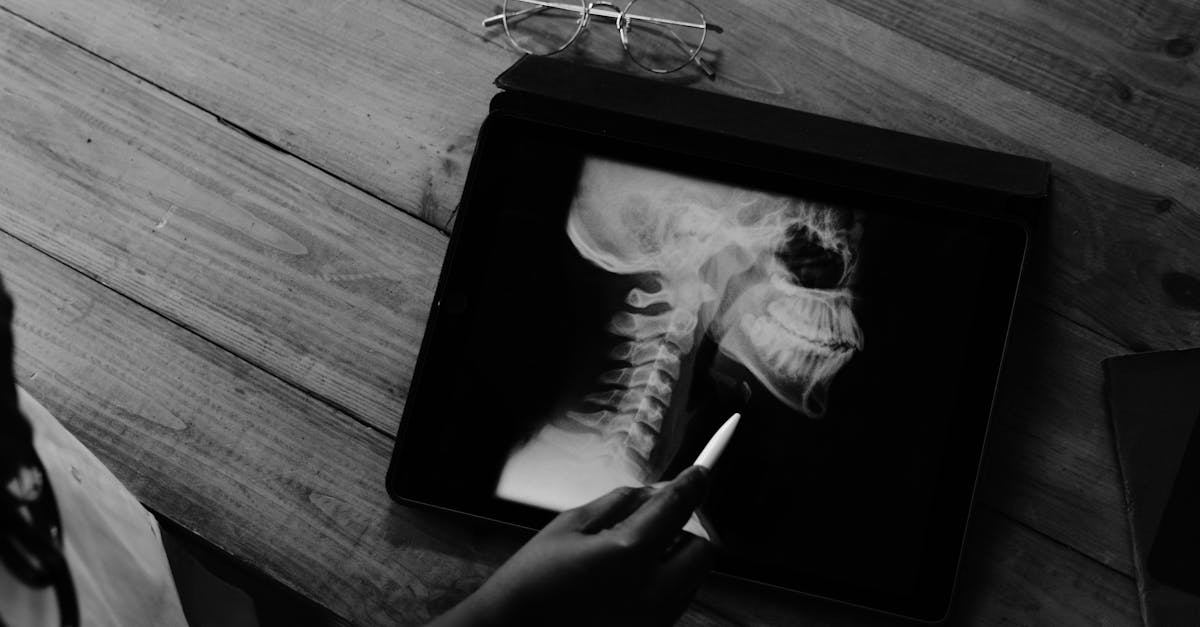 discover the causes, symptoms, and effective solutions for tech neck. learn how prolonged device use can affect your posture and neck health, plus expert tips for prevention and relief.